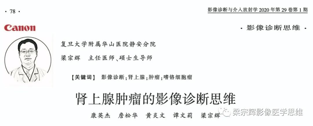 【病例】肾上腺嗜铬细胞瘤1例CT影像诊断思维