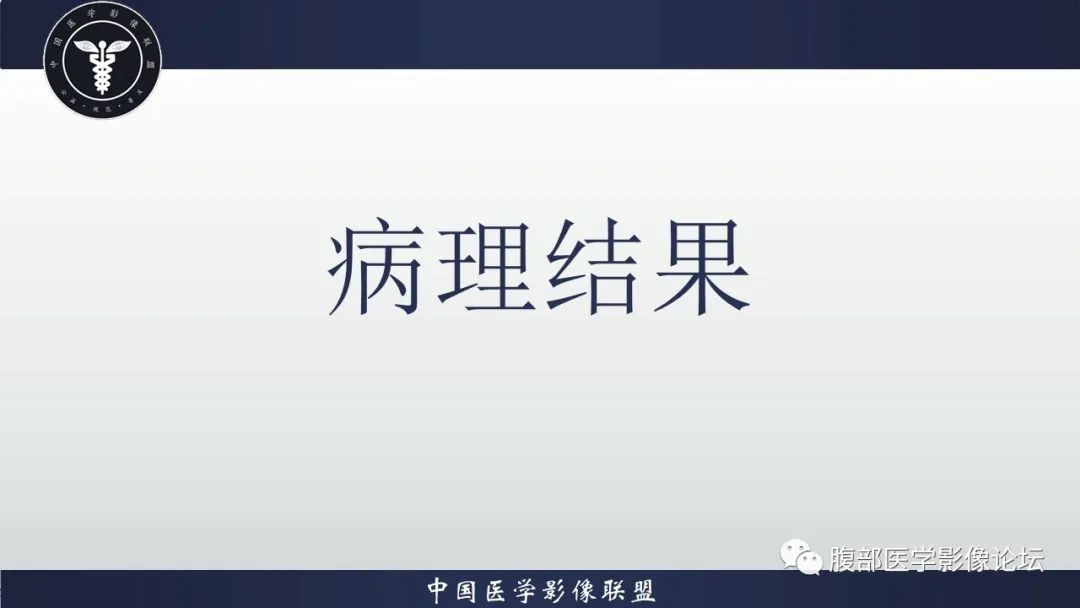 【病例】盆腔囊性成熟性畸胎瘤1例MR