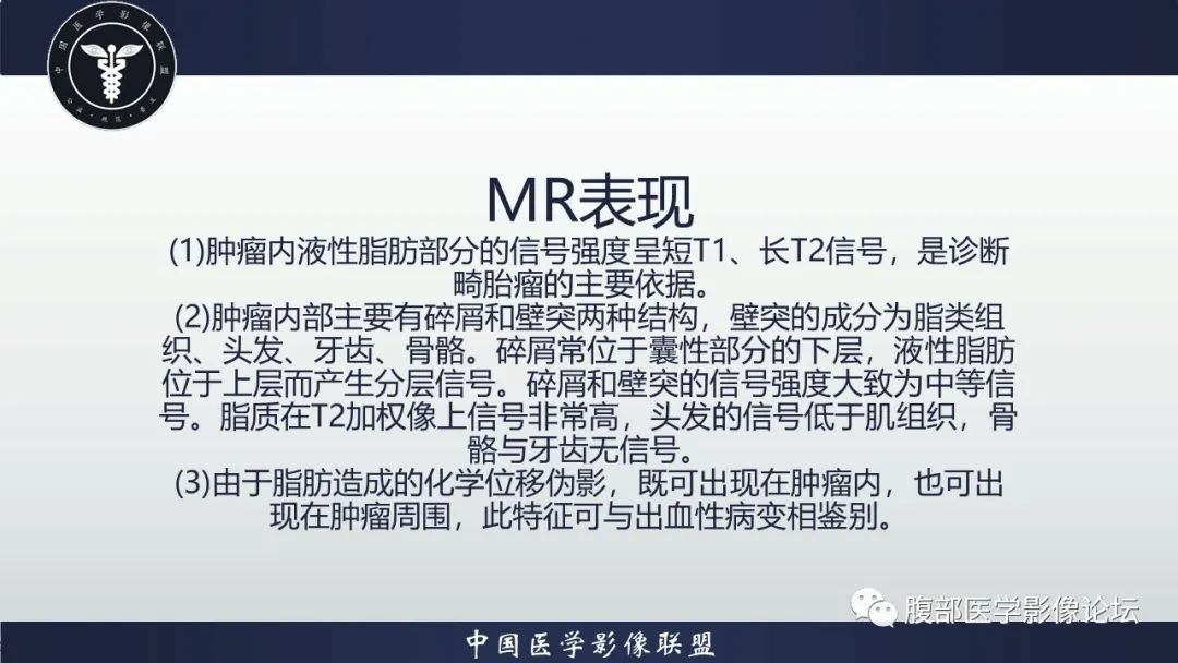 【病例】盆腔囊性成熟性畸胎瘤1例MR