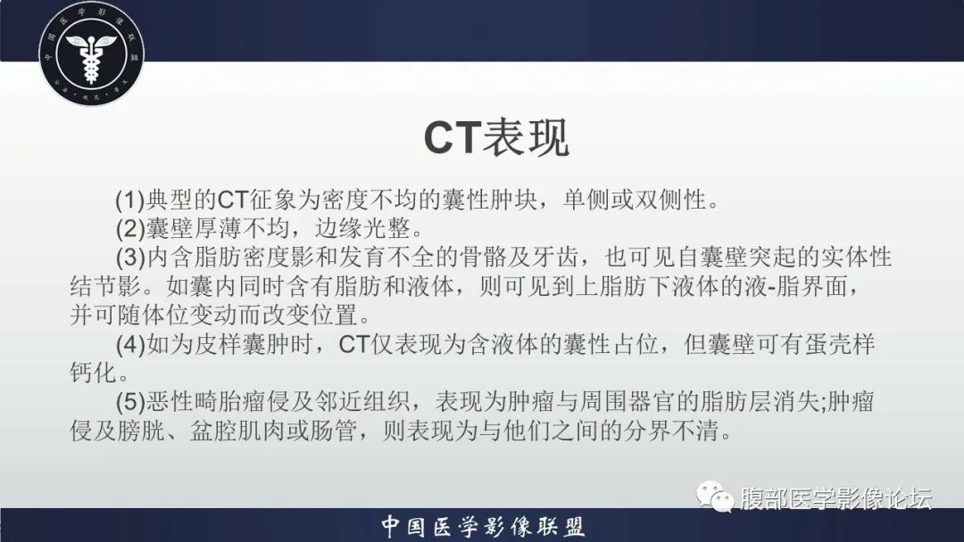 【病例】盆腔囊性成熟性畸胎瘤1例MR