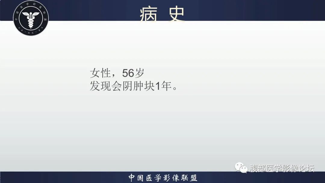 【病例】盆腔囊性成熟性畸胎瘤1例MR