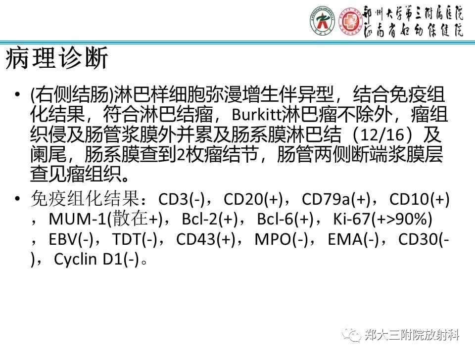 【PPT】小儿腹部伯基特Burkitt's淋巴瘤