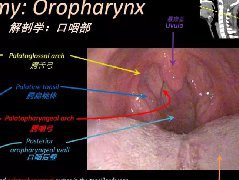 内窥镜对照的喉部CT解剖学研究