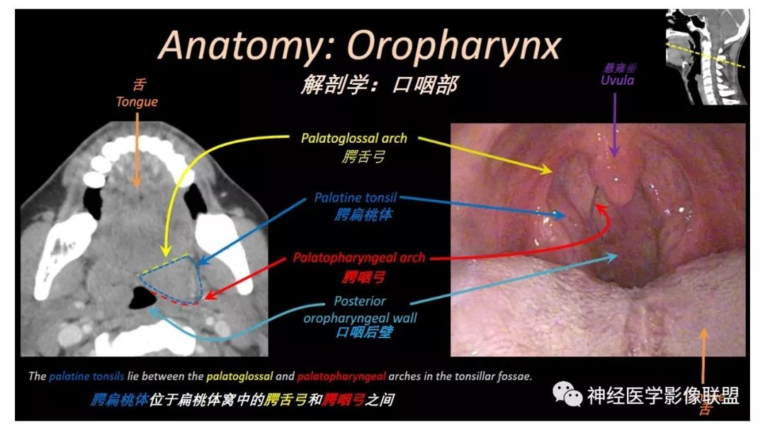 【PPT】内窥镜对照的喉部CT解剖学研究