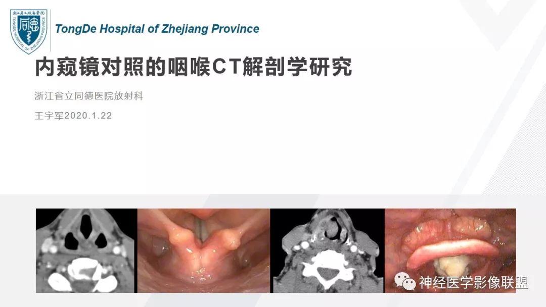 【PPT】内窥镜对照的喉部CT解剖学研究