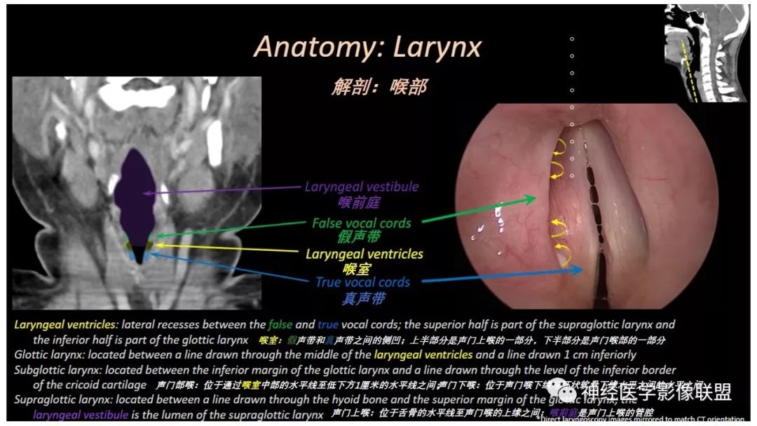 【PPT】内窥镜对照的喉部CT解剖学研究