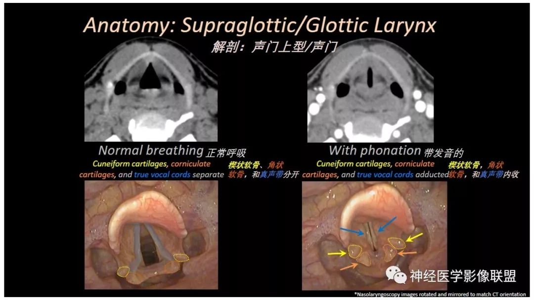 【PPT】内窥镜对照的喉部CT解剖学研究