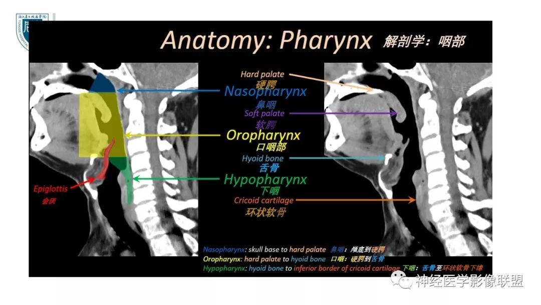 【PPT】内窥镜对照的喉部CT解剖学研究