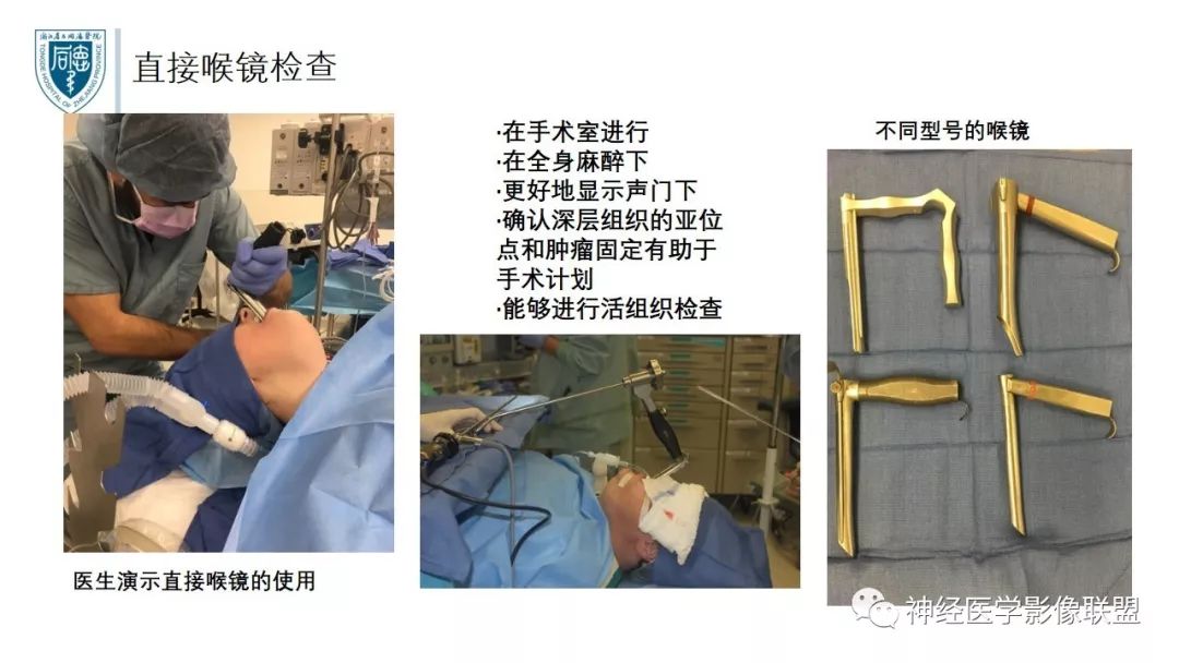 【PPT】内窥镜对照的喉部CT解剖学研究