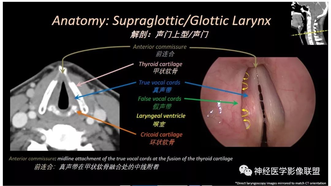 【PPT】内窥镜对照的喉部CT解剖学研究