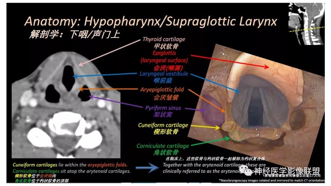 【PPT】内窥镜对照的喉部CT解剖学研究