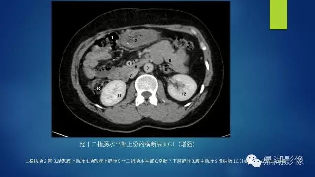 腹部CT超全断层解剖