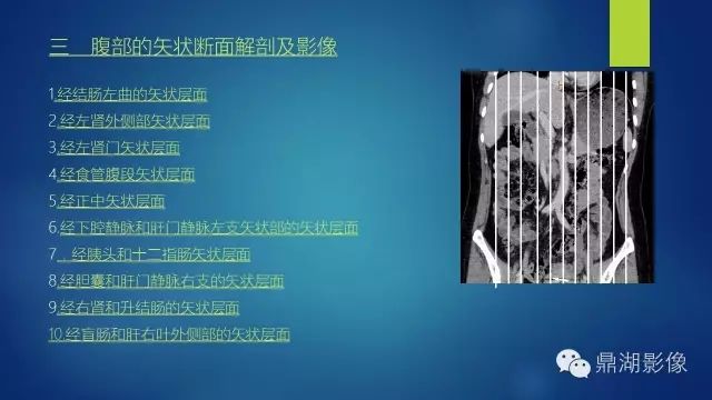 腹部CT超全断层解剖