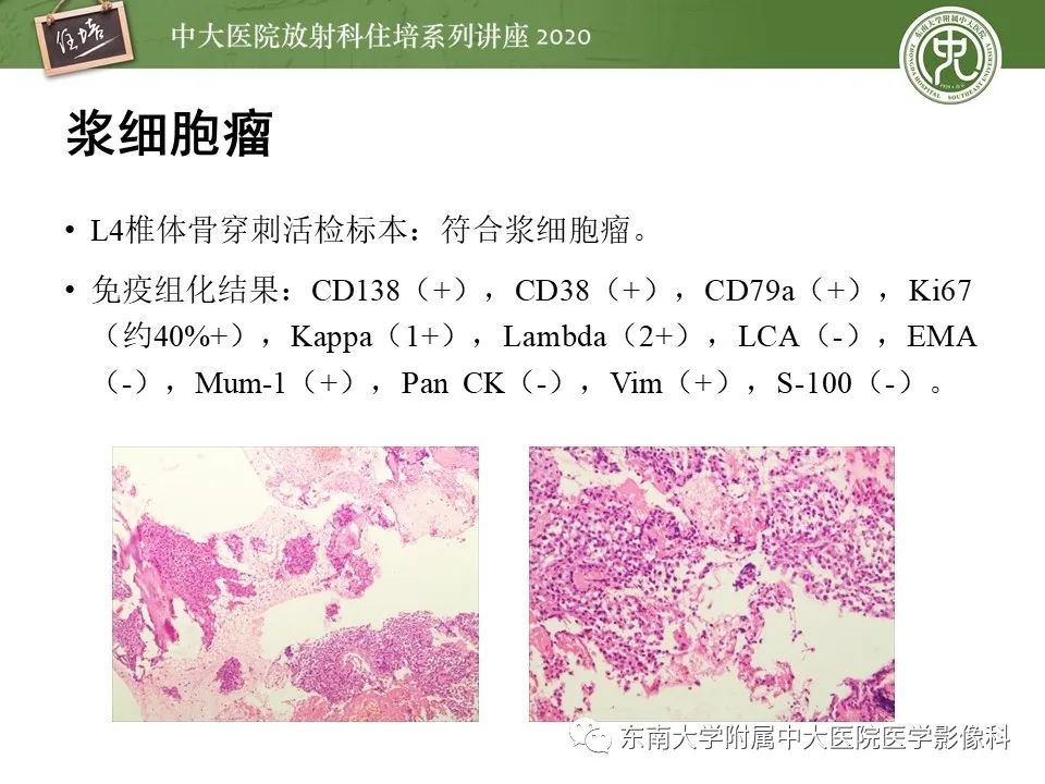 【PPT】脊柱骨源性病变影像分析思路及应用