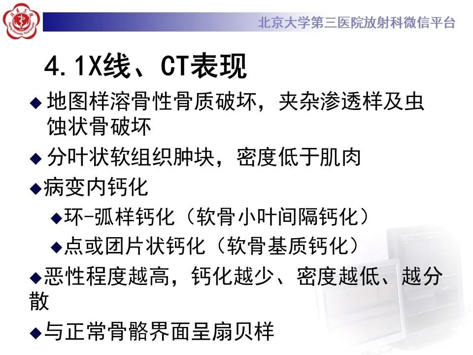 【PPT】原发性脊柱软骨肉瘤