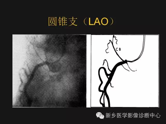 【PPT】冠状动脉造影正常解剖