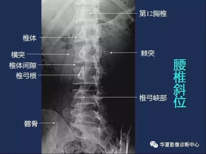 X线解剖图谱+系统解剖（骨骼篇）