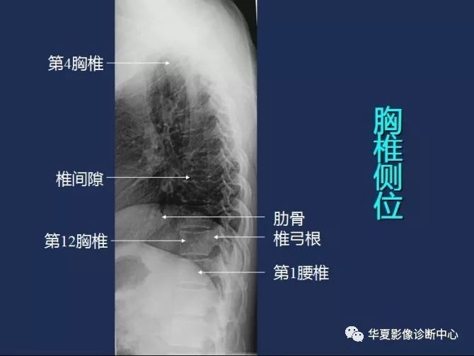 X线解剖图谱+系统解剖（骨骼篇）