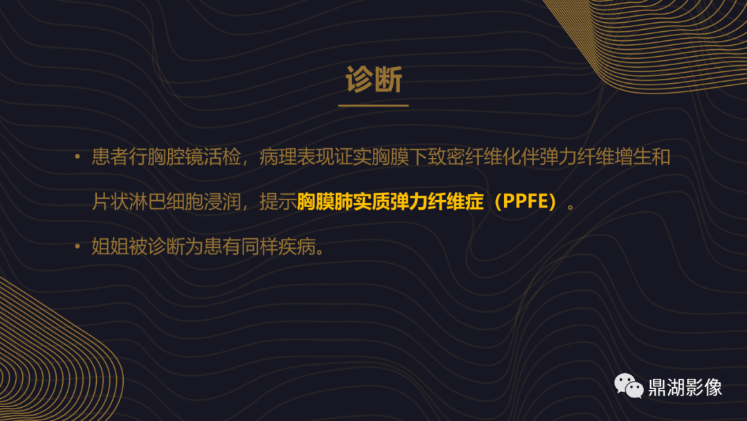 【病例】胸膜肺实质弹力纤维增生症1例CT影像