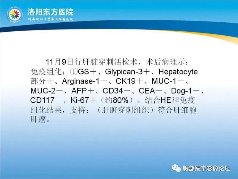 【病例】胃肝样腺癌肝内多发转移1例CT影像 【病例】胃肝样腺癌肝内多发转移1例CT影像