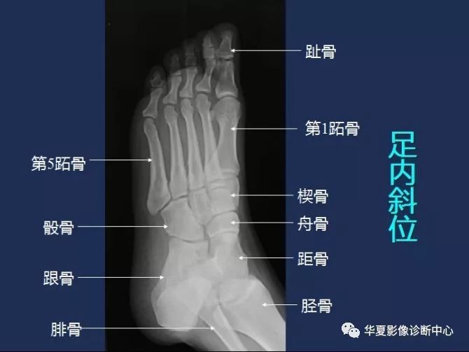 X线解剖图谱+系统解剖（骨骼篇）