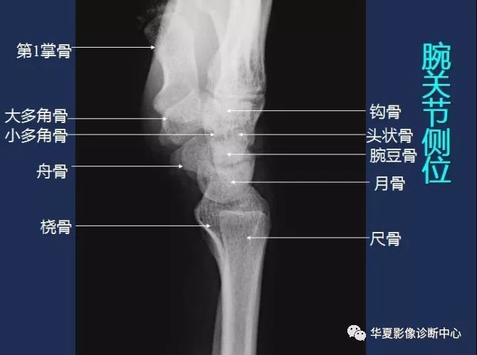X线解剖图谱+系统解剖（骨骼篇）