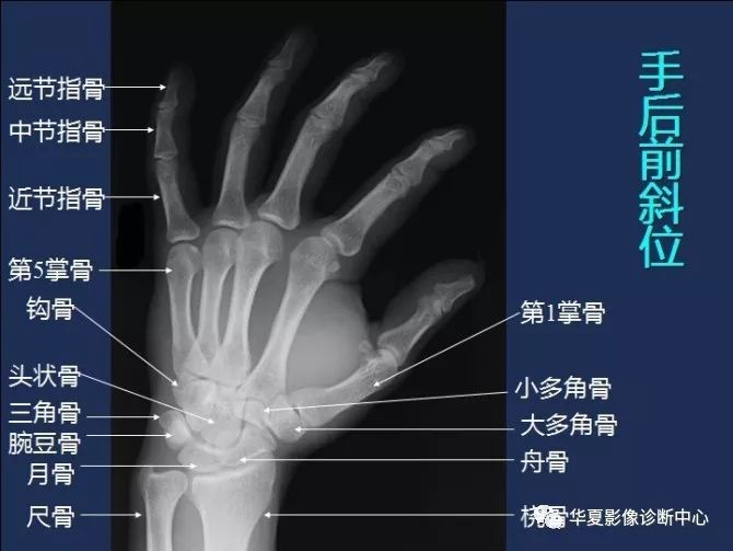 X线解剖图谱+系统解剖（骨骼篇）