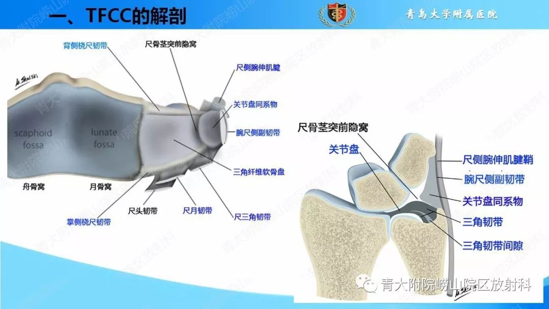 【PPT】TFCC损伤的MRI诊断