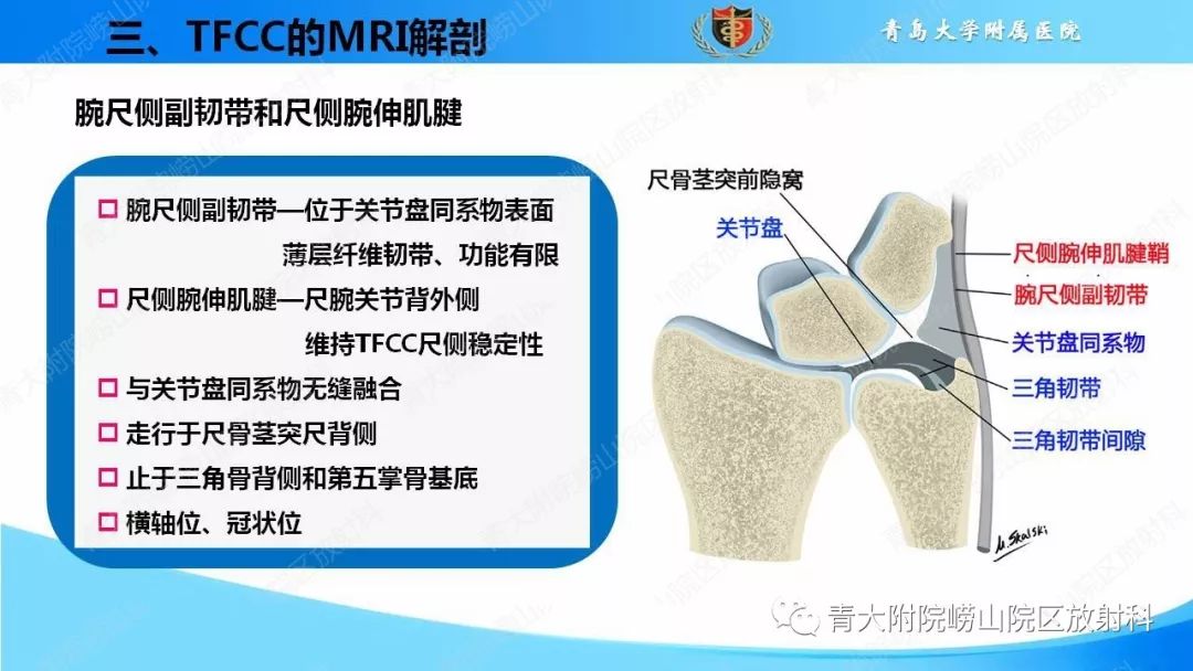 【PPT】TFCC损伤的MRI诊断