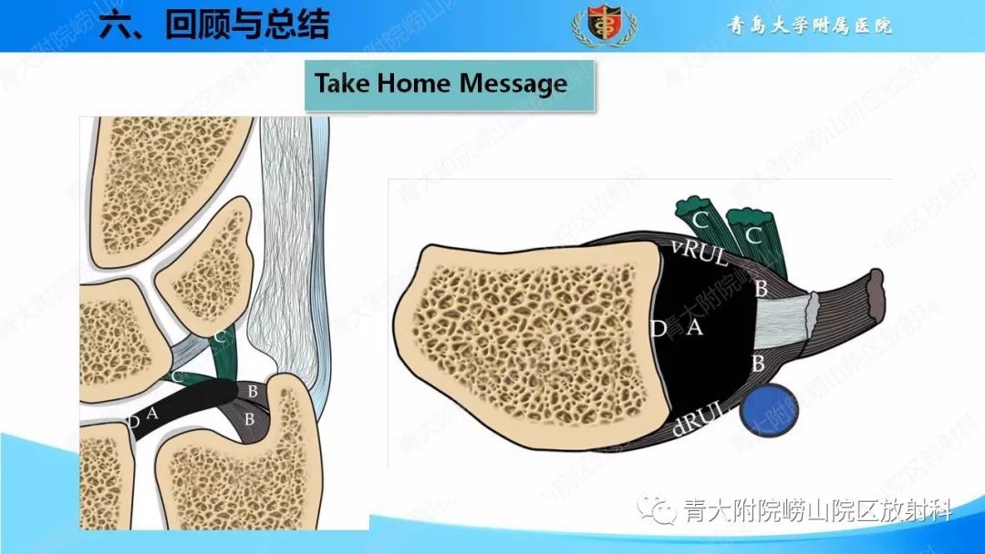 【PPT】TFCC损伤的MRI诊断