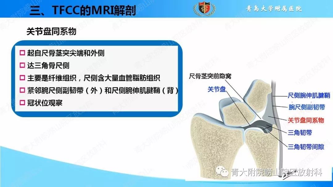 【PPT】TFCC损伤的MRI诊断