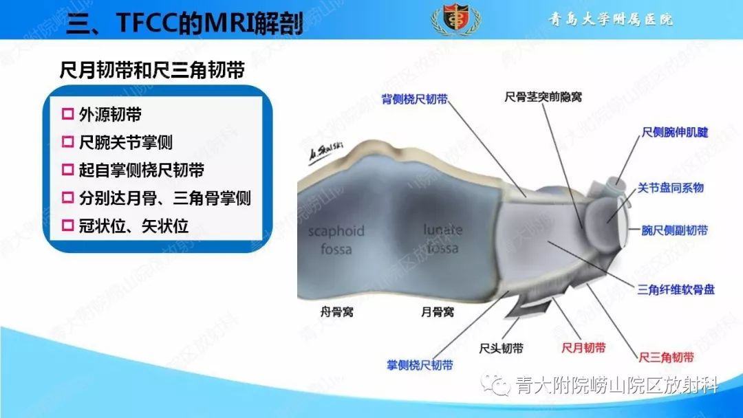 【PPT】TFCC损伤的MRI诊断