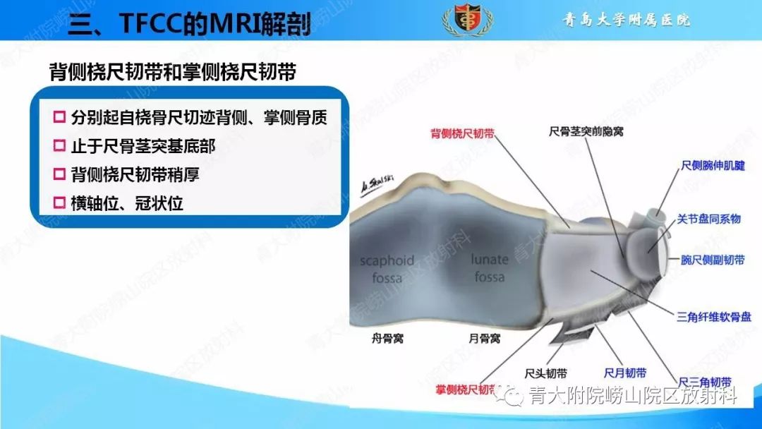 【PPT】TFCC损伤的MRI诊断