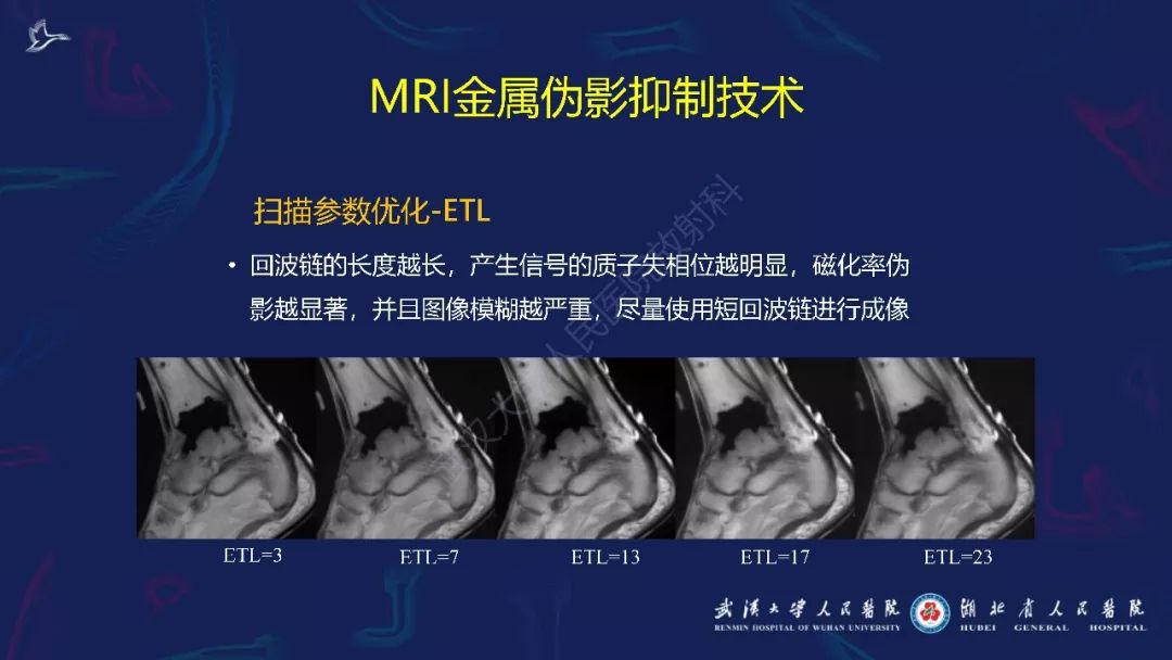【PPT】肌骨MRI金属伪影抑制技术临床应用