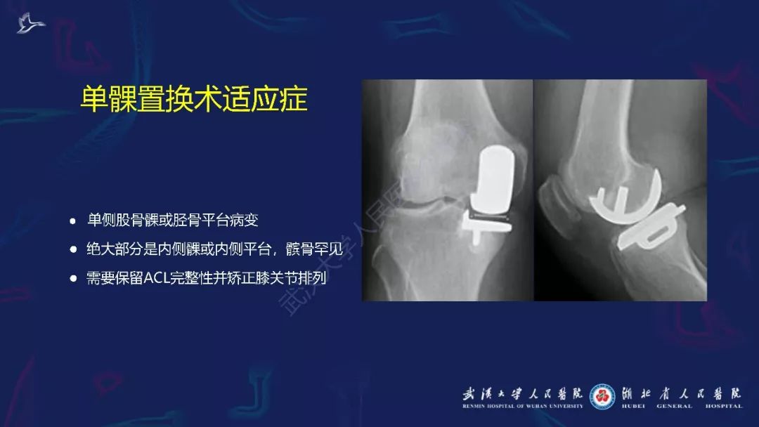 【PPT】肌骨MRI金属伪影抑制技术临床应用