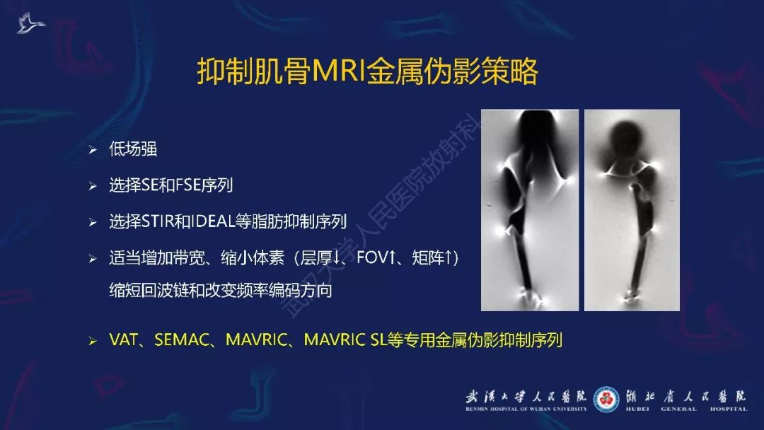 【PPT】肌骨MRI金属伪影抑制技术临床应用