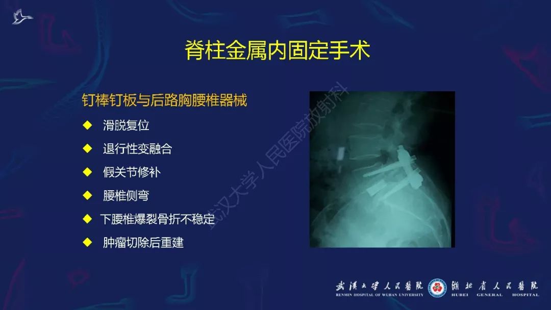 【PPT】肌骨MRI金属伪影抑制技术临床应用