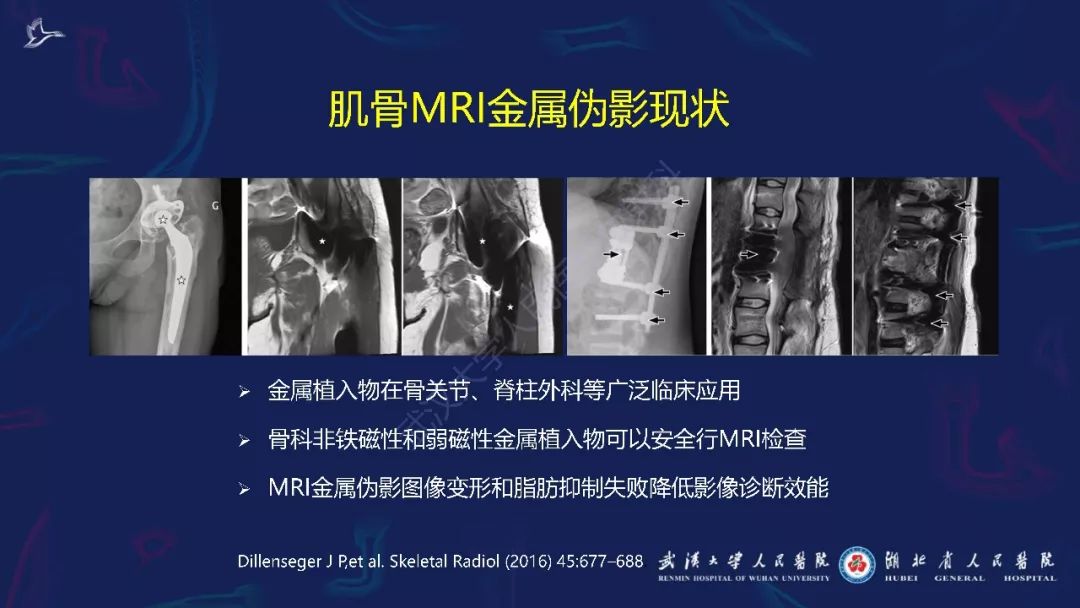 【PPT】肌骨MRI金属伪影抑制技术临床应用