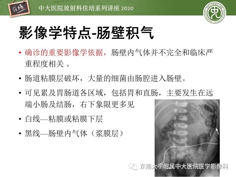 【PPT】新生儿坏死性小肠结肠炎的影像学表现