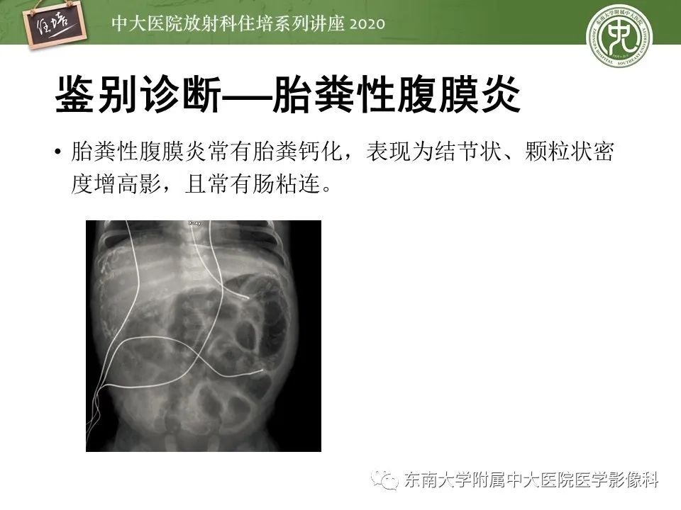 【PPT】新生儿坏死性小肠结肠炎的影像学表现