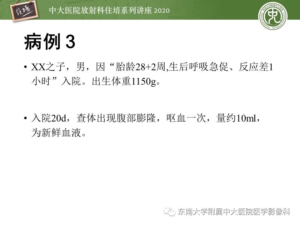 【PPT】新生儿坏死性小肠结肠炎的影像学表现