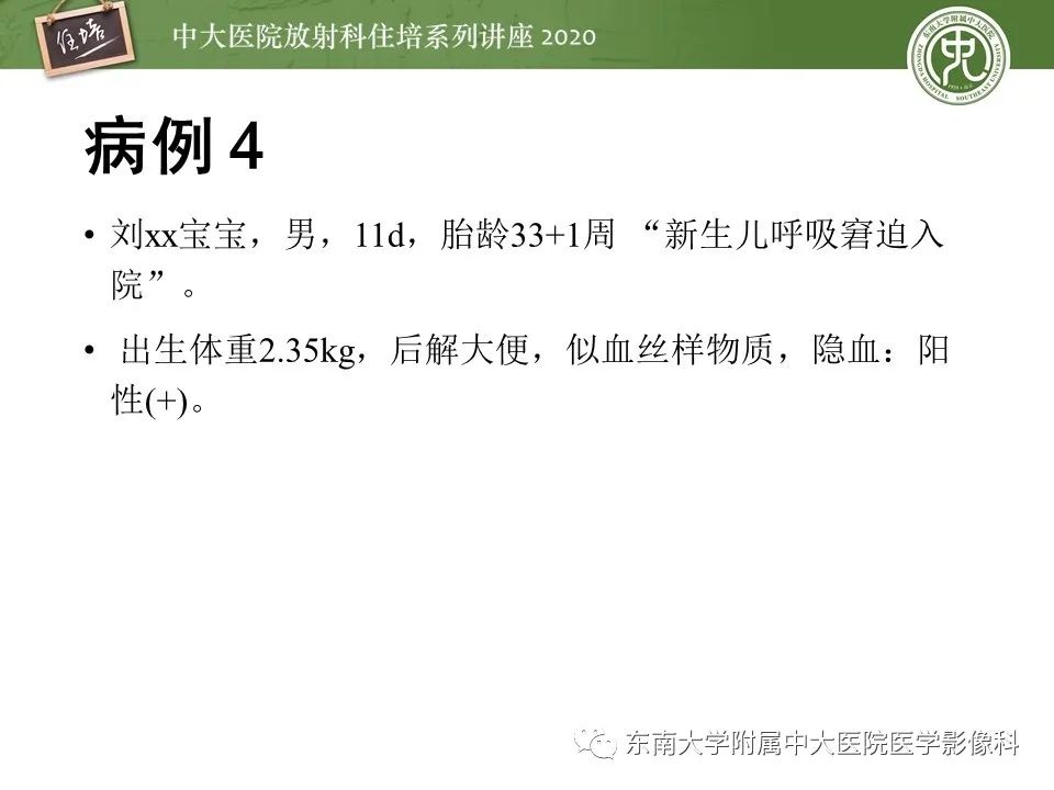 【PPT】新生儿坏死性小肠结肠炎的影像学表现