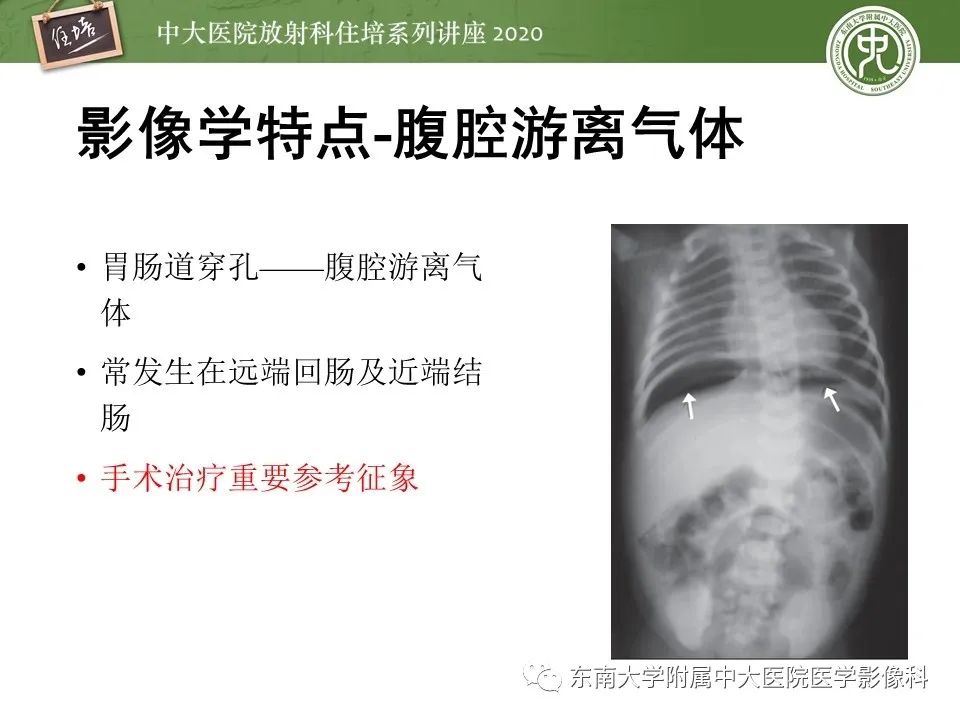 【PPT】新生儿坏死性小肠结肠炎的影像学表现