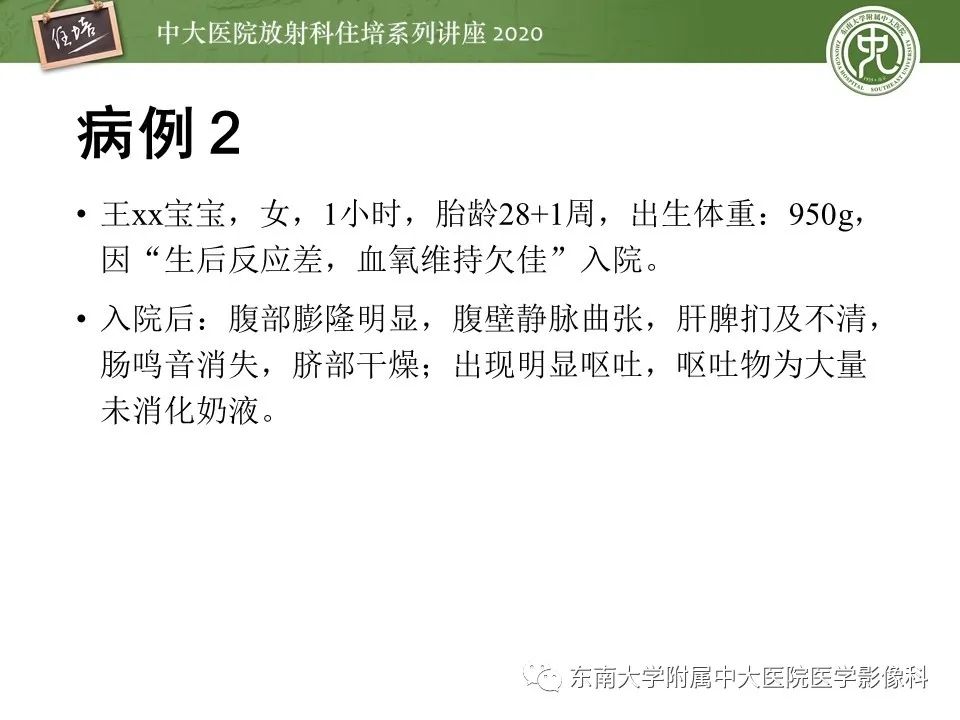 【PPT】新生儿坏死性小肠结肠炎的影像学表现
