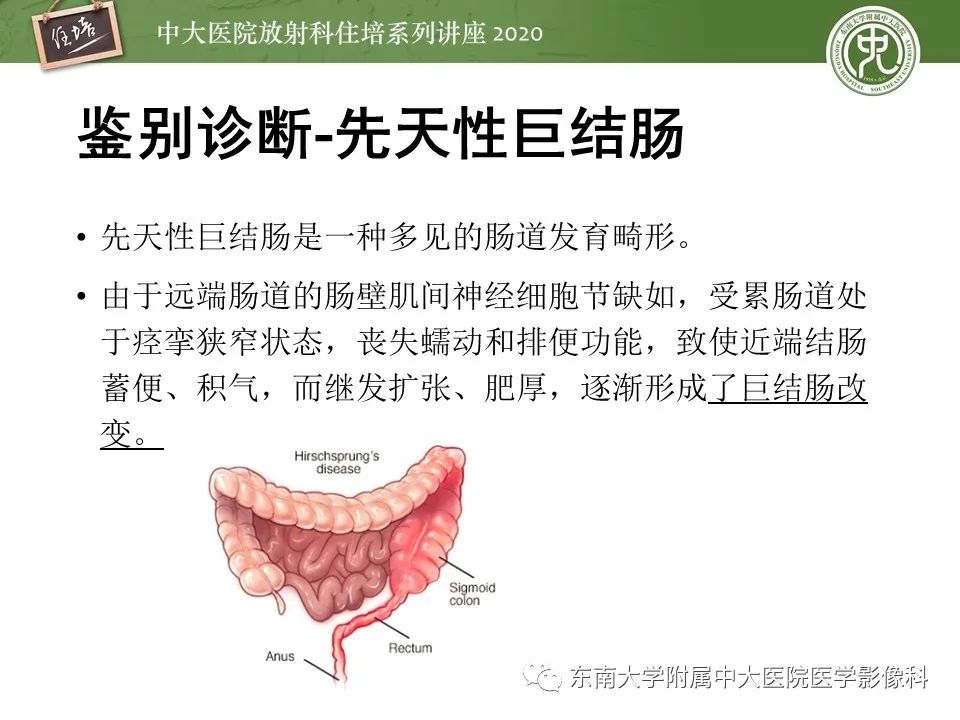 【PPT】新生儿坏死性小肠结肠炎的影像学表现