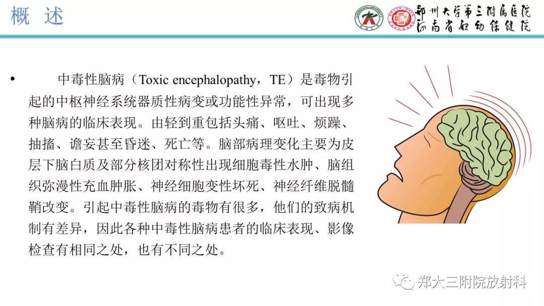 【PPT】中毒性脑病影像诊断