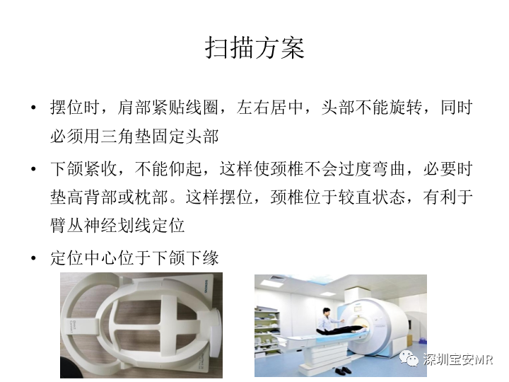 【PPT】臂丛神经MR扫描