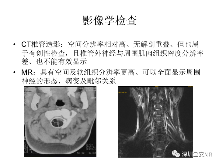 【PPT】臂丛神经MR扫描