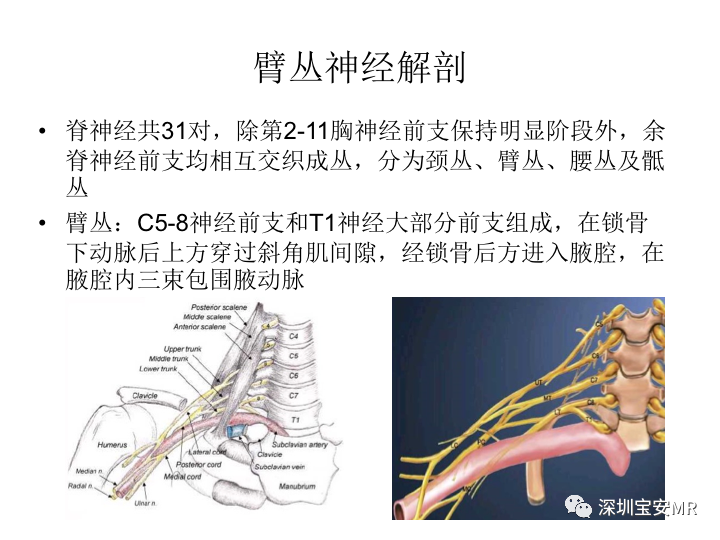 臂丛神经MR扫描
