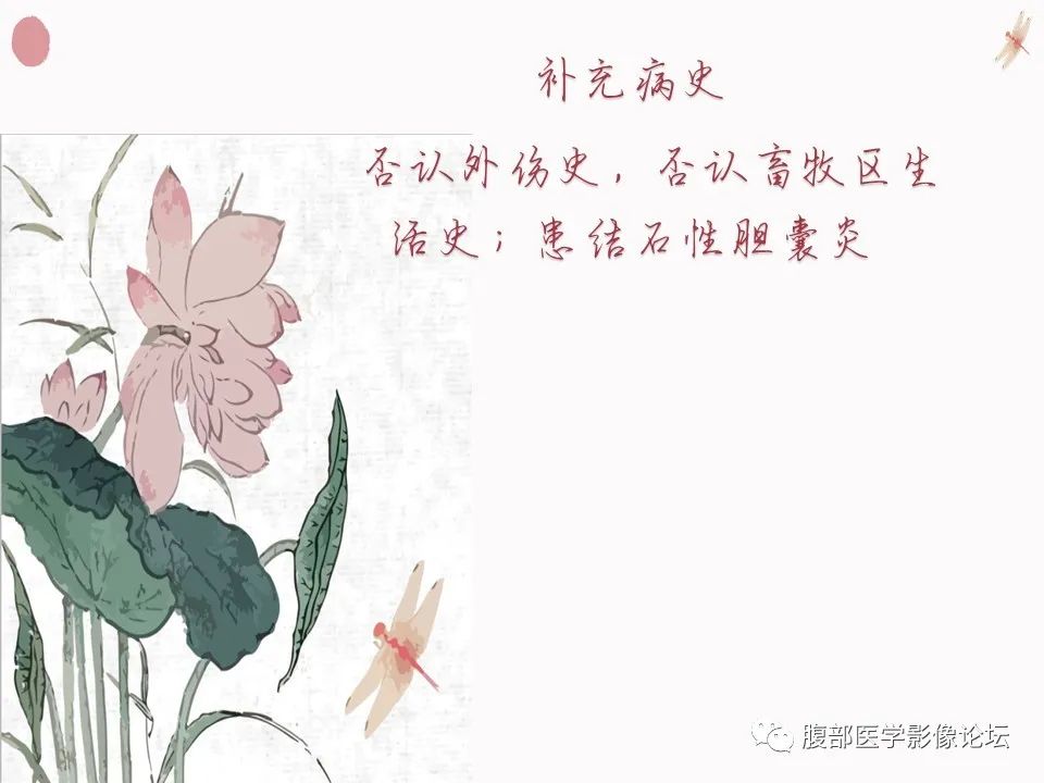 【PPT】肝脏良性囊肿影像诊断